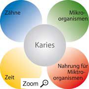Ursachen Ursachen